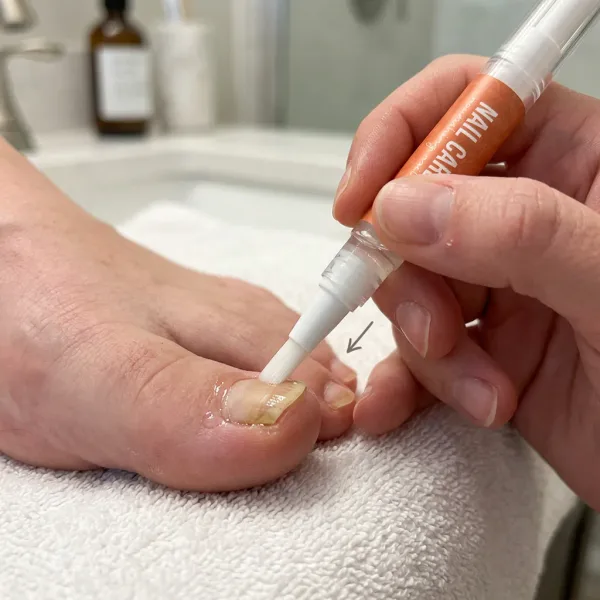 Applying the Fungabeam Pen brush tip to a toenail